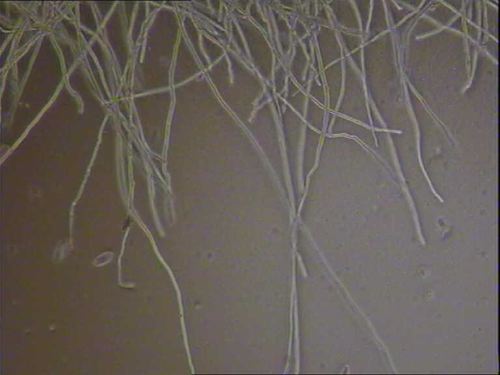 Image 1: Sarcoscypha coccinea hair3